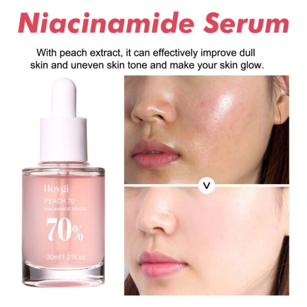 Esencia Facial de Niacinamida Hidratante - Imagen 2
