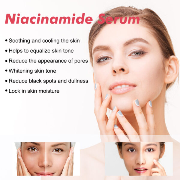 Esencia Facial de Niacinamida Hidratante - Imagen 5