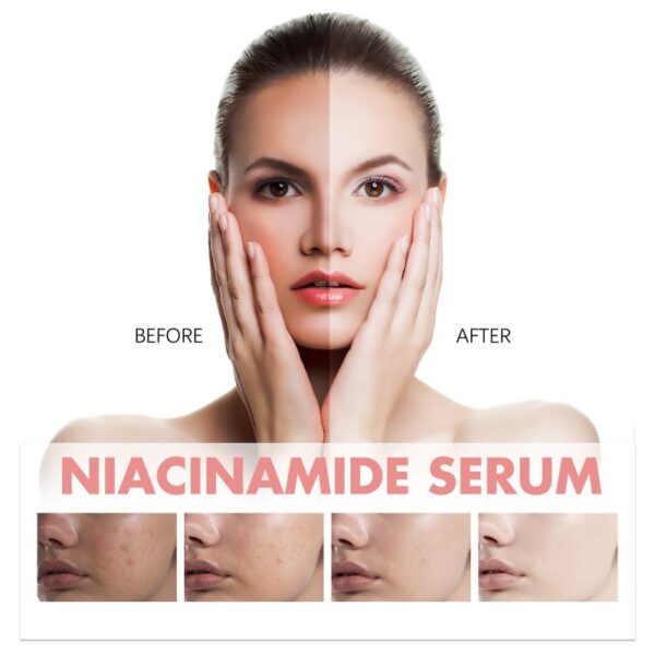 Esencia Facial de Niacinamida Hidratante - Imagen 6